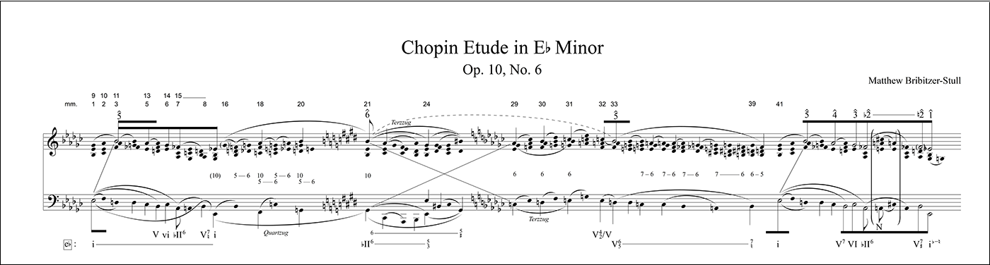 Chopin Etude in Eb Min - Unearthing Hidden Treasure: Finale's Worksheets and Repertoire